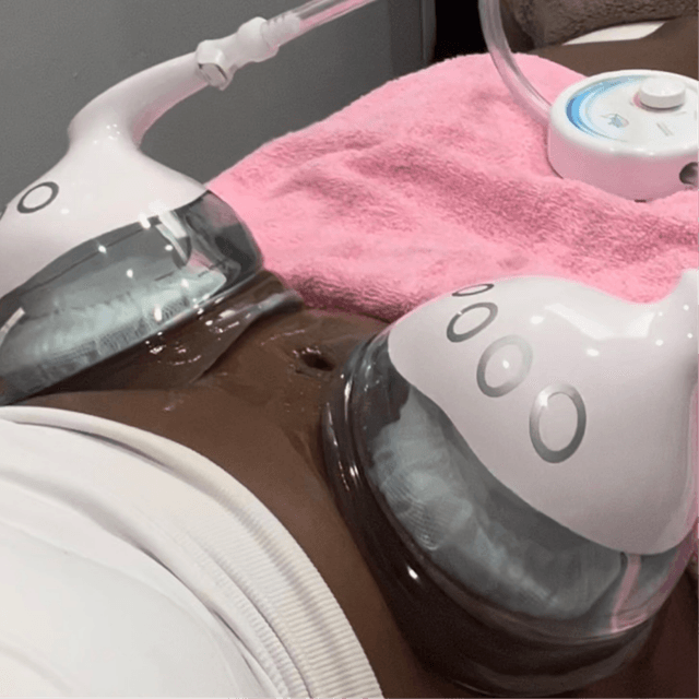 6 Cold Therapy Treatments at To Cut & Dye For | Sculpted with Kare in Los Angeles, CA