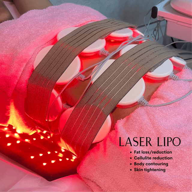 6 Laser Lipo Treatments at To Cut & Dye For | Sculpted with Kare in Los Angeles, CA
