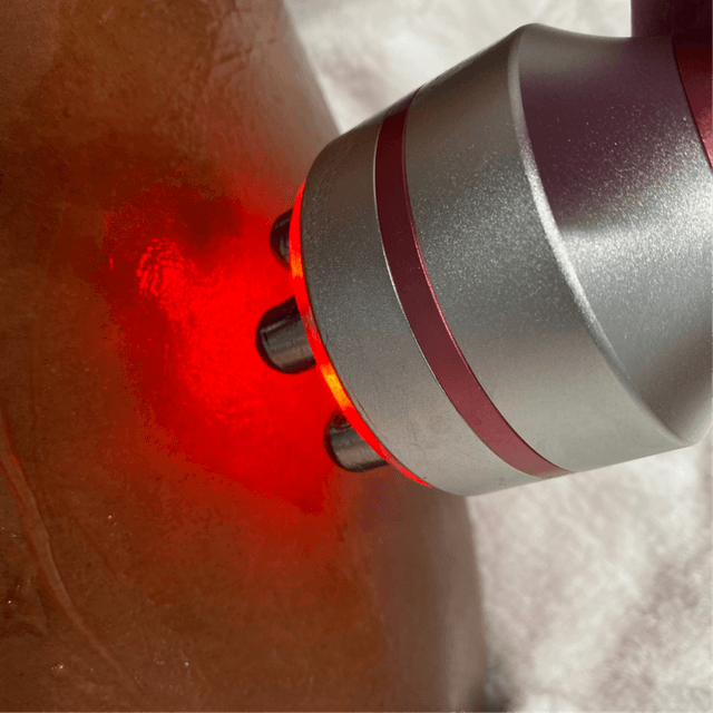 6 RF Skin Tightening Treatments at To Cut & Dye For | Sculpted with Kare in Los Angeles, CA
